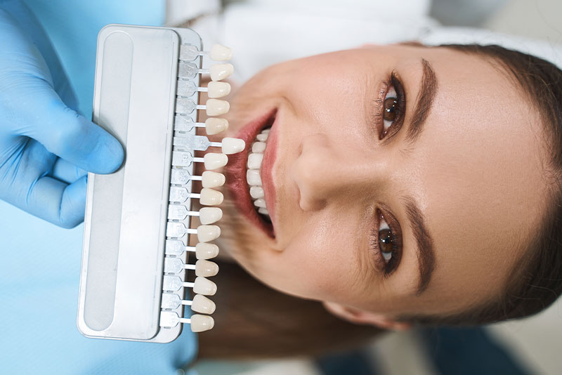 Veneers Türkei, Zahnbehandlung TÜrkei